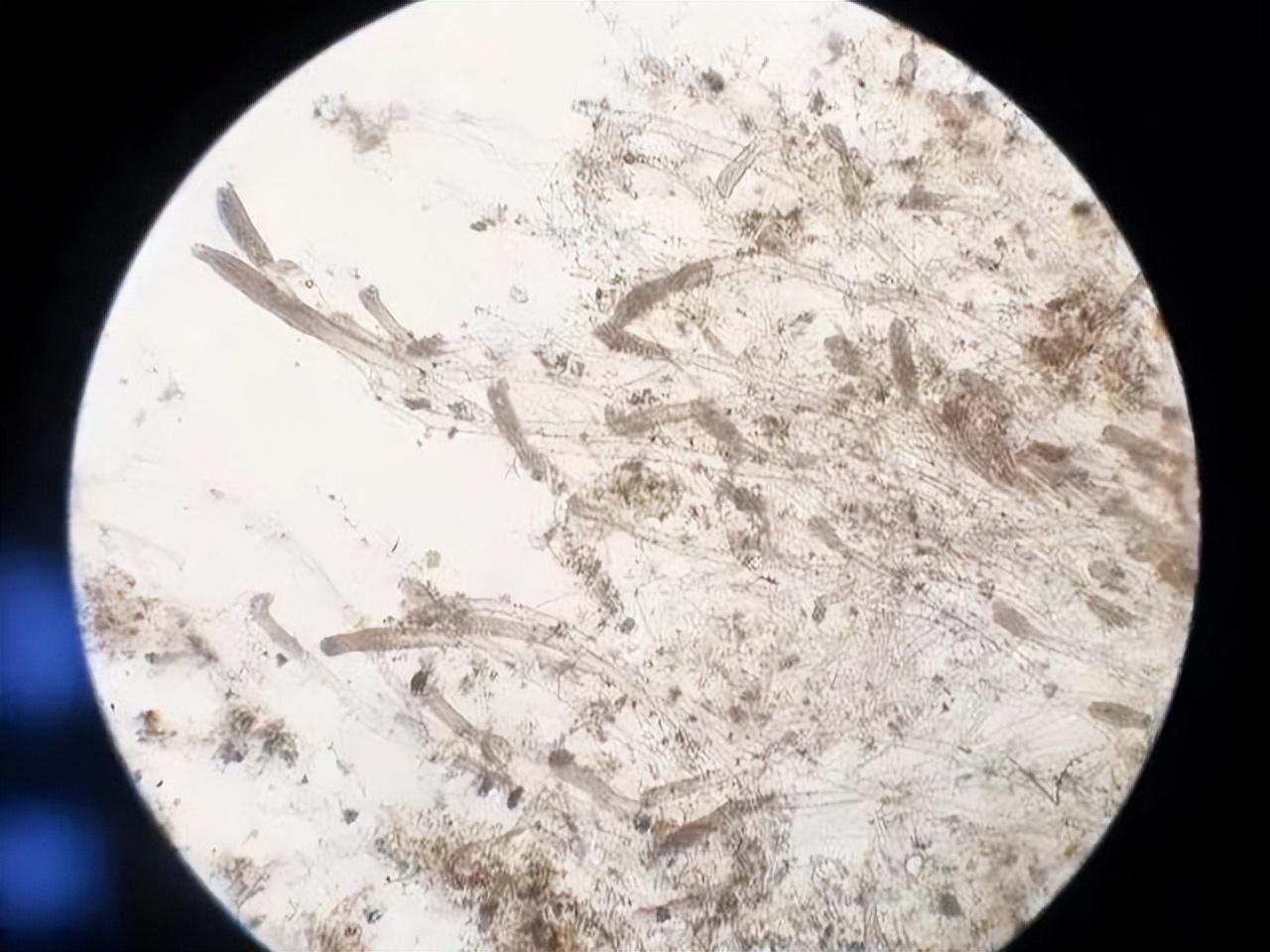 鱼身上起白霜是怎么了(鱼身上起白霜是怎么治疗)